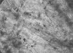 MBR污泥膨脹怎么處理？污泥膨脹的處理方法(圖2)